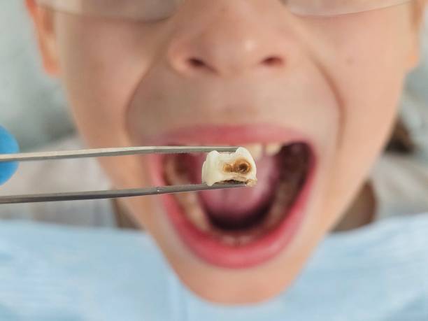 Best Emergency Denture Repair in Camn, DE